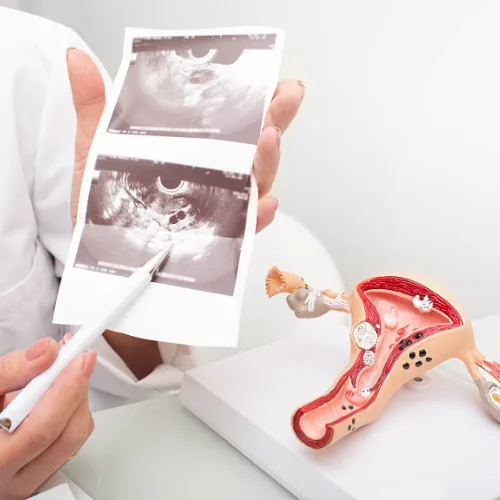 Cáncer cervicouterino en CDMX: guía integral desde ginecología especializada