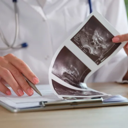 Entendiendo el dolor menstrual: Atención especializada en CDMX