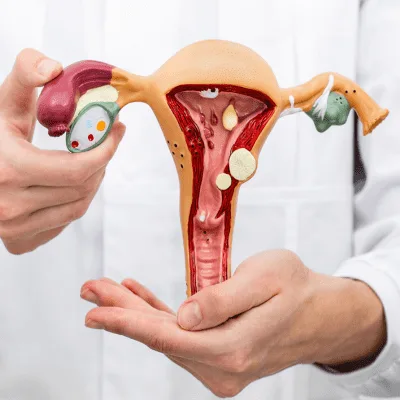 Endometriosis en CDMX: comprensión integral de esta enfermedad ginecológica