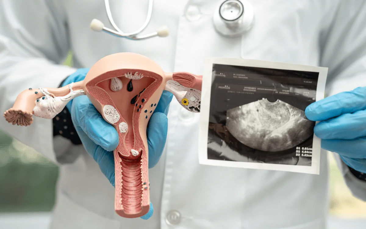 Infección vaginal en CDMX